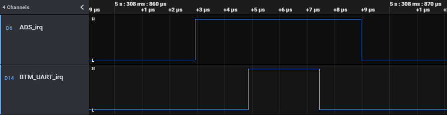 logic capture of irq