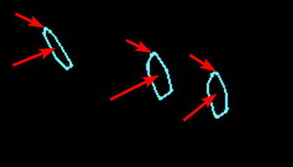 Image of three similar blobs with their centers and tops roughly pointed out