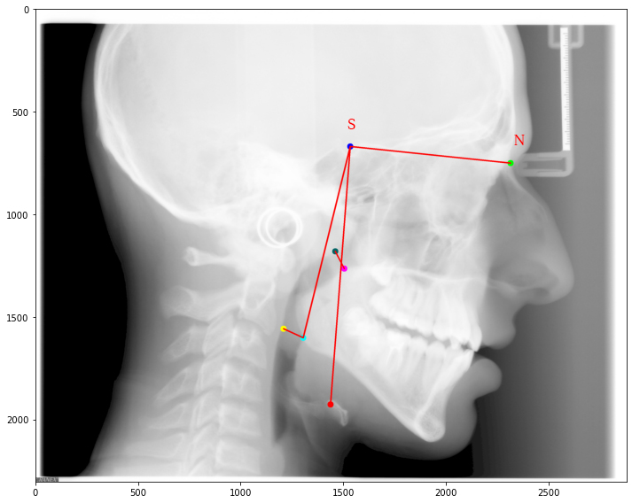 (Though there are some other points which also I plotted here.) -