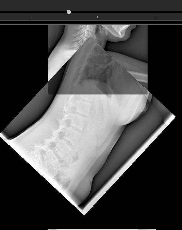 Second approach result